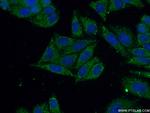 YTHDF2 Antibody in Immunocytochemistry (ICC/IF)