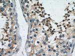 YTHDF2 Antibody in Immunohistochemistry (Paraffin) (IHC (P))