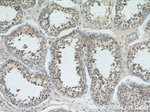 YTHDF2 Antibody in Immunohistochemistry (Paraffin) (IHC (P))