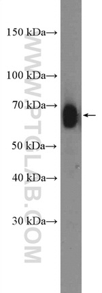 YTHDF2 Antibody in Western Blot (WB)