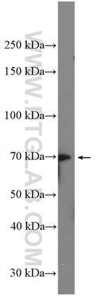 YTHDF2 Antibody in Western Blot (WB)