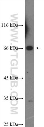 YTHDF2 Antibody in Western Blot (WB)