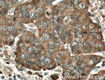 MYO6 Antibody in Immunohistochemistry (Paraffin) (IHC (P))