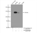 MYO6 Antibody in Immunoprecipitation (IP)