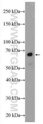 GCGR Antibody in Western Blot (WB)