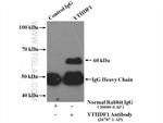 YTHDF1 Antibody in Immunoprecipitation (IP)