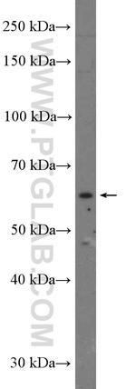 YTHDF1 Antibody in Western Blot (WB)