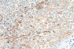 RASGRF2 Antibody in Immunohistochemistry (Paraffin) (IHC (P))