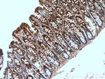 GRLF1 Antibody in Immunohistochemistry (Paraffin) (IHC (P))