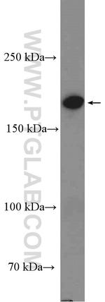 GRLF1 Antibody in Western Blot (WB)