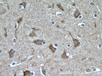 GRLF1 Antibody in Immunohistochemistry (Paraffin) (IHC (P))