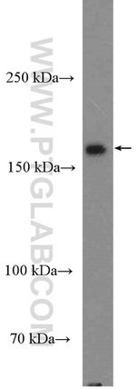 GRLF1 Antibody in Western Blot (WB)