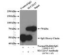 SLC22A7 Antibody in Immunoprecipitation (IP)