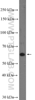 SLC22A7 Antibody in Western Blot (WB)