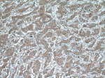 SLC25A12 Antibody in Immunohistochemistry (Paraffin) (IHC (P))