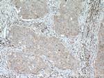 SLC25A12 Antibody in Immunohistochemistry (Paraffin) (IHC (P))