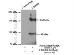 CRKRS Antibody in Immunoprecipitation (IP)