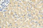 ADAMTS18 Antibody in Immunohistochemistry (Paraffin) (IHC (P))