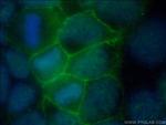 FLVCR1 Antibody in Immunocytochemistry (ICC/IF)