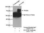 FLVCR1 Antibody in Immunoprecipitation (IP)