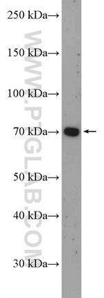 FLVCR1 Antibody in Western Blot (WB)