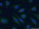 TRAF1 Antibody in Immunocytochemistry (ICC/IF)