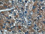 TRAF2 Antibody in Immunohistochemistry (Paraffin) (IHC (P))