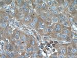 LTBP1 Antibody in Immunohistochemistry (Paraffin) (IHC (P))