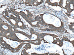 RAF1 Antibody in Immunohistochemistry (Paraffin) (IHC (P))