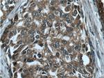 RAF1 Antibody in Immunohistochemistry (Paraffin) (IHC (P))