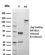 Growth Hormone Antibody in SDS-PAGE (SDS-PAGE)