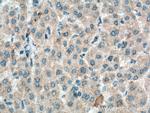 HGF alpha Antibody in Immunohistochemistry (Paraffin) (IHC (P))