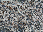 HGF alpha Antibody in Immunohistochemistry (Paraffin) (IHC (P))