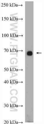 HGF alpha Antibody in Western Blot (WB)