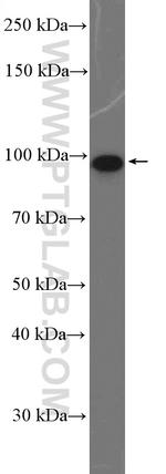 DDX54 Antibody in Western Blot (WB)