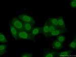 HNRNPM Antibody in Immunocytochemistry (ICC/IF)