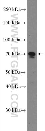 HNRNPM Antibody in Western Blot (WB)