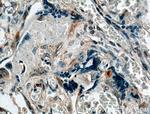 PKC zeta Antibody in Immunohistochemistry (Paraffin) (IHC (P))