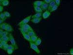 NDRG1 Antibody in Immunocytochemistry (ICC/IF)