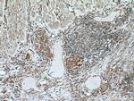 NDRG1 Antibody in Immunohistochemistry (Paraffin) (IHC (P))