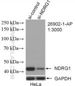 NDRG1 Antibody in Western Blot (WB)