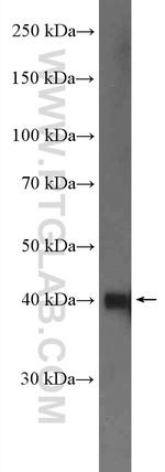 NDRG1 Antibody in Western Blot (WB)