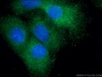 Uteroglobin Antibody in Immunocytochemistry (ICC/IF)