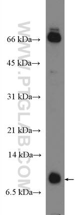 Uteroglobin Antibody in Western Blot (WB)