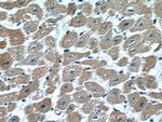 VEGFD Antibody in Immunohistochemistry (Paraffin) (IHC (P))