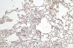 VEGFD Antibody in Immunohistochemistry (Paraffin) (IHC (P))