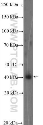 VEGFD Antibody in Western Blot (WB)