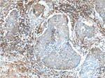 Integrin beta-1 Antibody in Immunohistochemistry (Paraffin) (IHC (P))