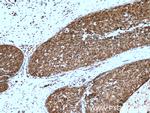 PSMD9 Antibody in Immunohistochemistry (Paraffin) (IHC (P))