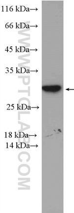 PSMD9 Antibody in Western Blot (WB)